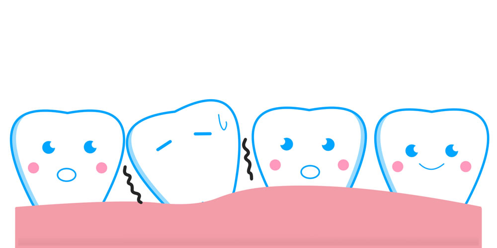 歯がグラグラと動く原因について