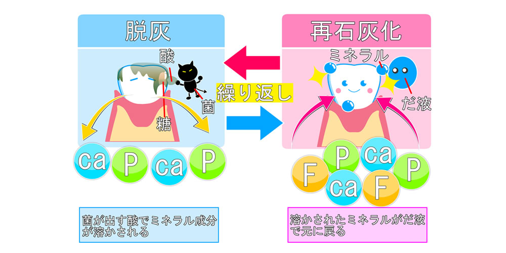 歯の再石灰化の仕組み